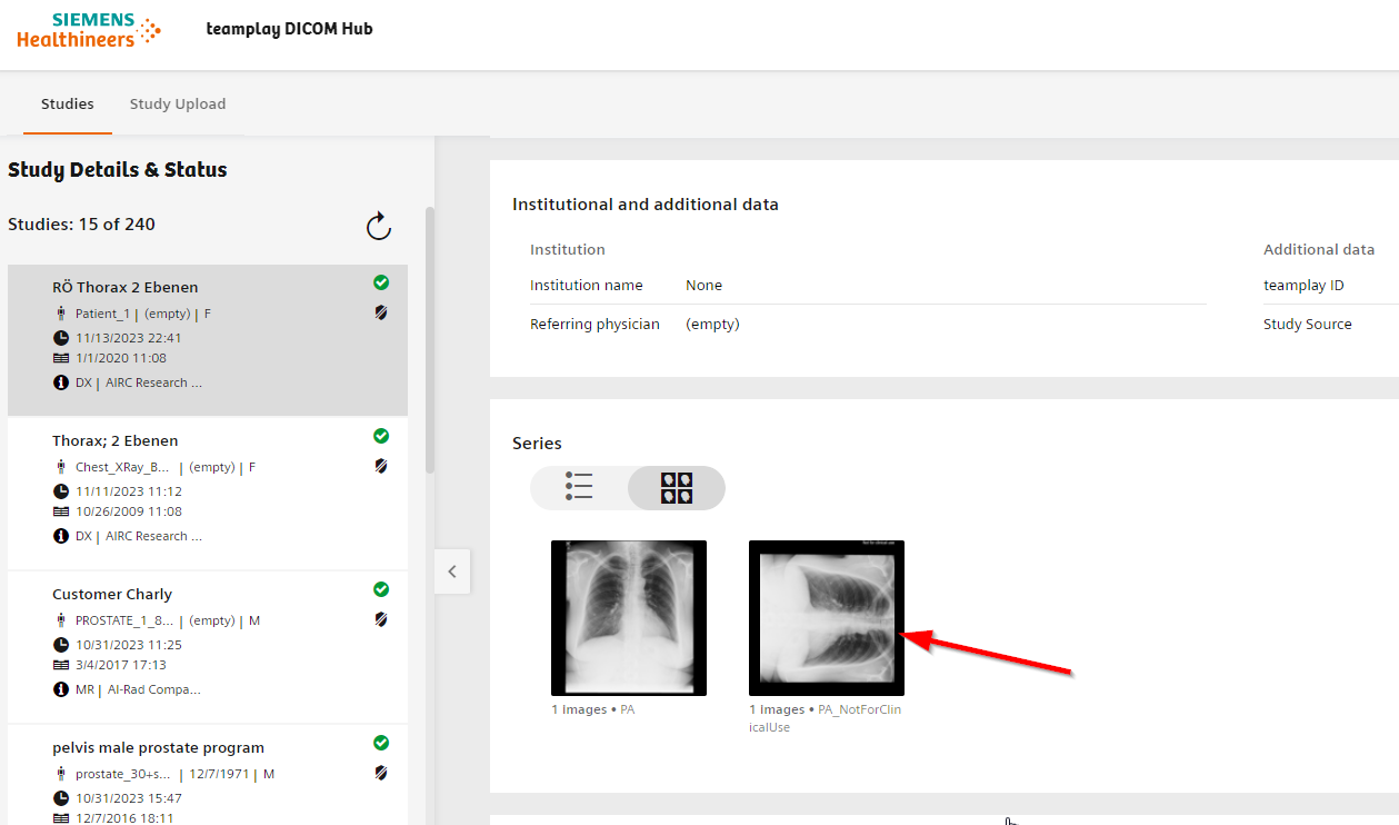 Output from the example script shown in teamplay DICOM hub. Prototype result